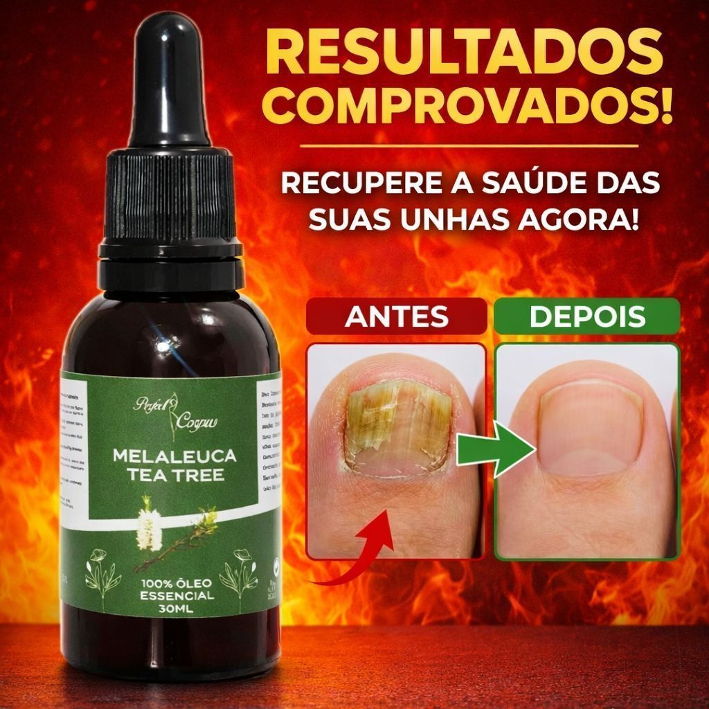 Óleo Essencial de Melaleuca Com Contra Gotas 100% Puro 30ML