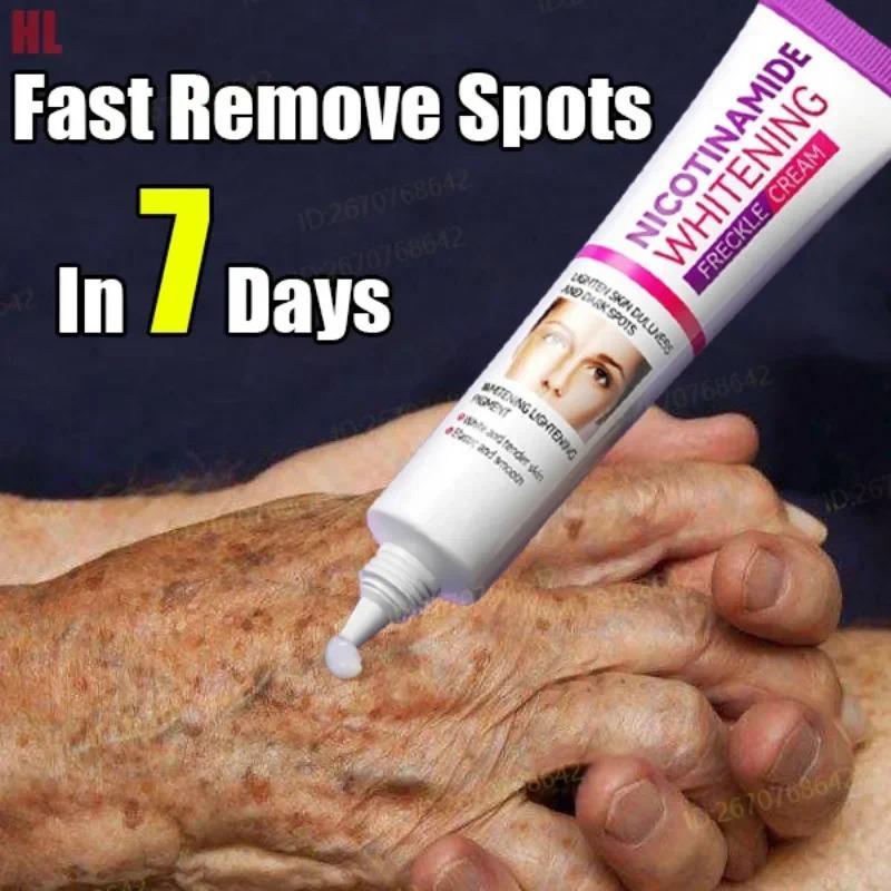 Creme De Melasma Clareador De Niacinamida Suave , Melanina , Remove Pigmento Escuro , Hidratante , Cuidados Com A Pele