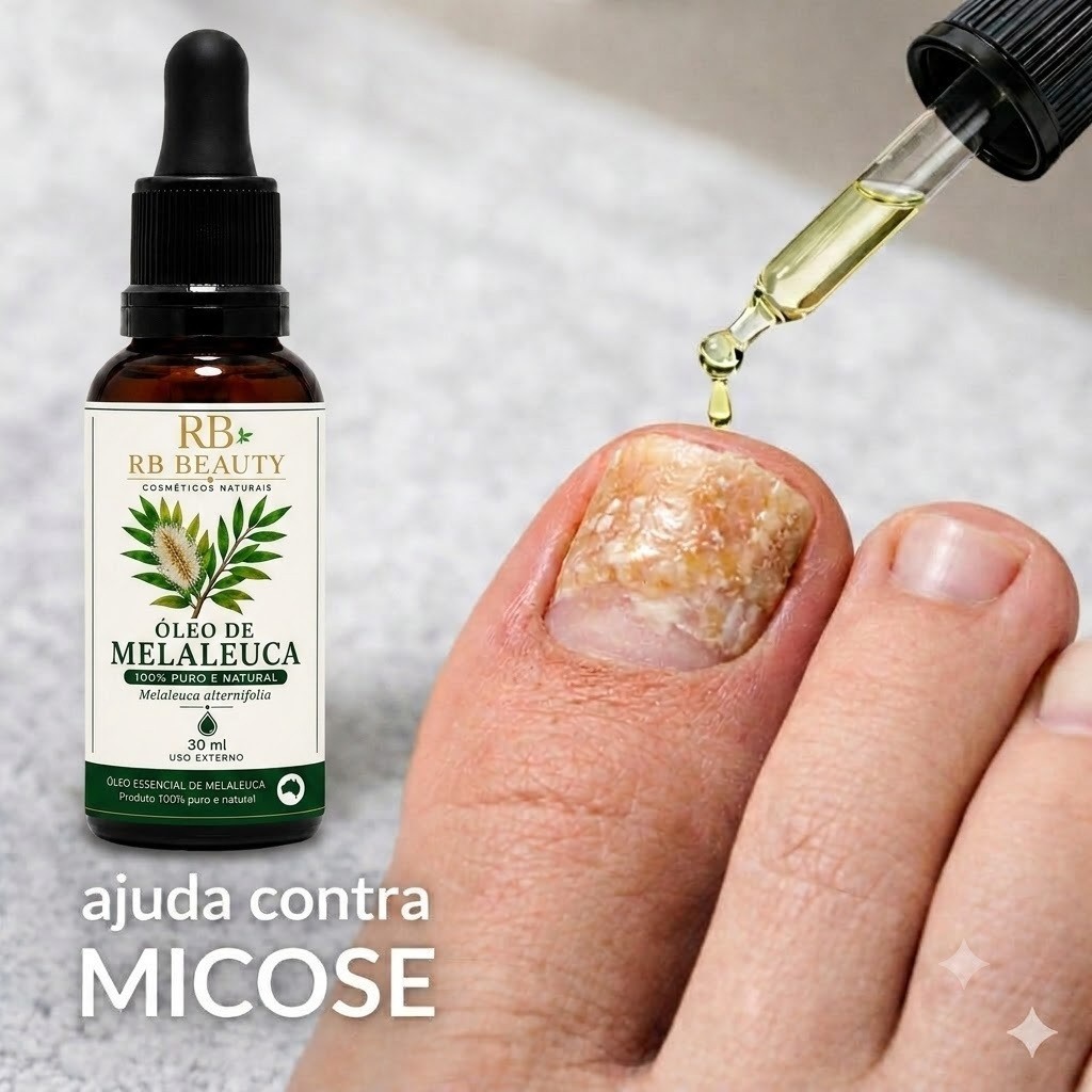 Kit 3 Óleo Essencial de Melaleuca 30ml Cada - Com Conta Gotas - CONTEM VARIAÇÃO — imagem 2 de 2