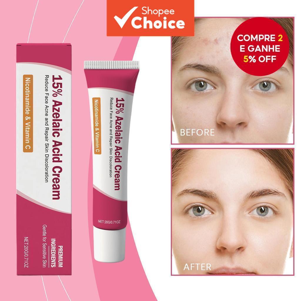 Creme Facial Niacinamida & Ácido Salicílico 20g com Óleo de Árvore do Chá & Vitamina C – Equilíbrio de Óleo & Redução
