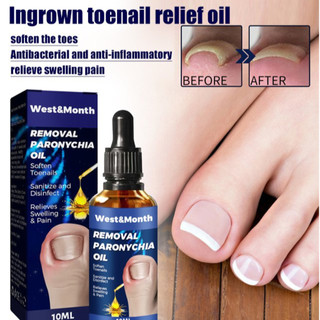 [Fácil Aplicação] Óleo para cuidado de unhas, ideal para unhas encravadas e sensíveis. Óleo/Unhas/Encravadas