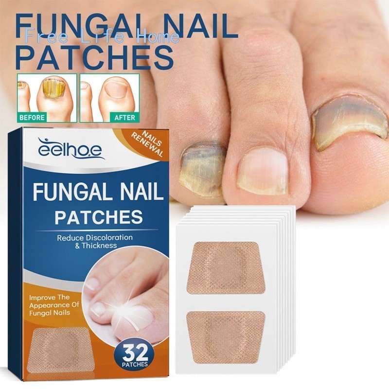 32 Adesivos Antifúngicos Para Tratamento De Unhas , Reparos De Onicomicose , De Venda Quente