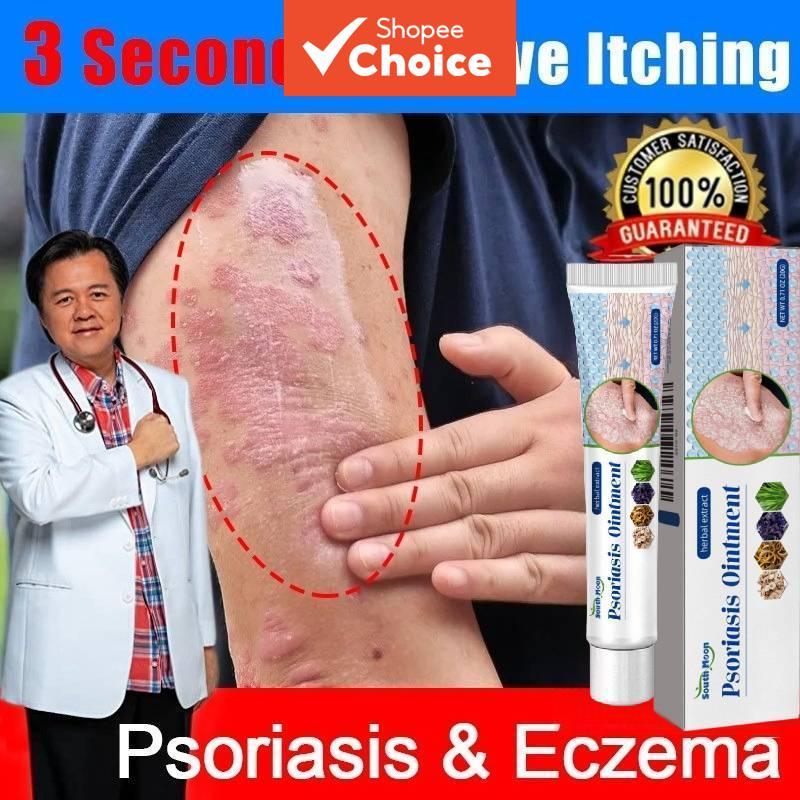  Creme Antisséptico 20g - Pomada Antibacteriana para Coceira, Eczema e Psoríase (Versão Atualizada)