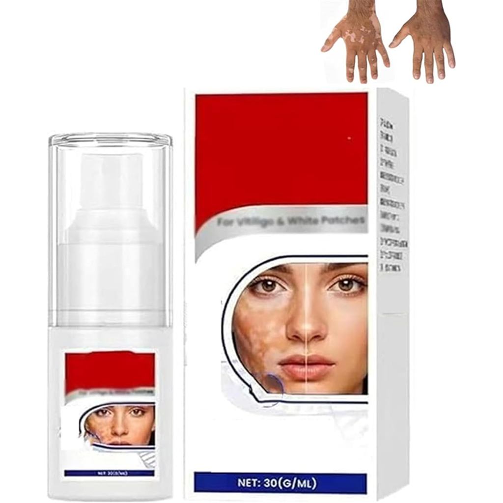 Spray para Vitiligo, Creme para Sardas, Spray para Tratamento de Vitiligo, Removedor Profissional de Manchas Brancas par