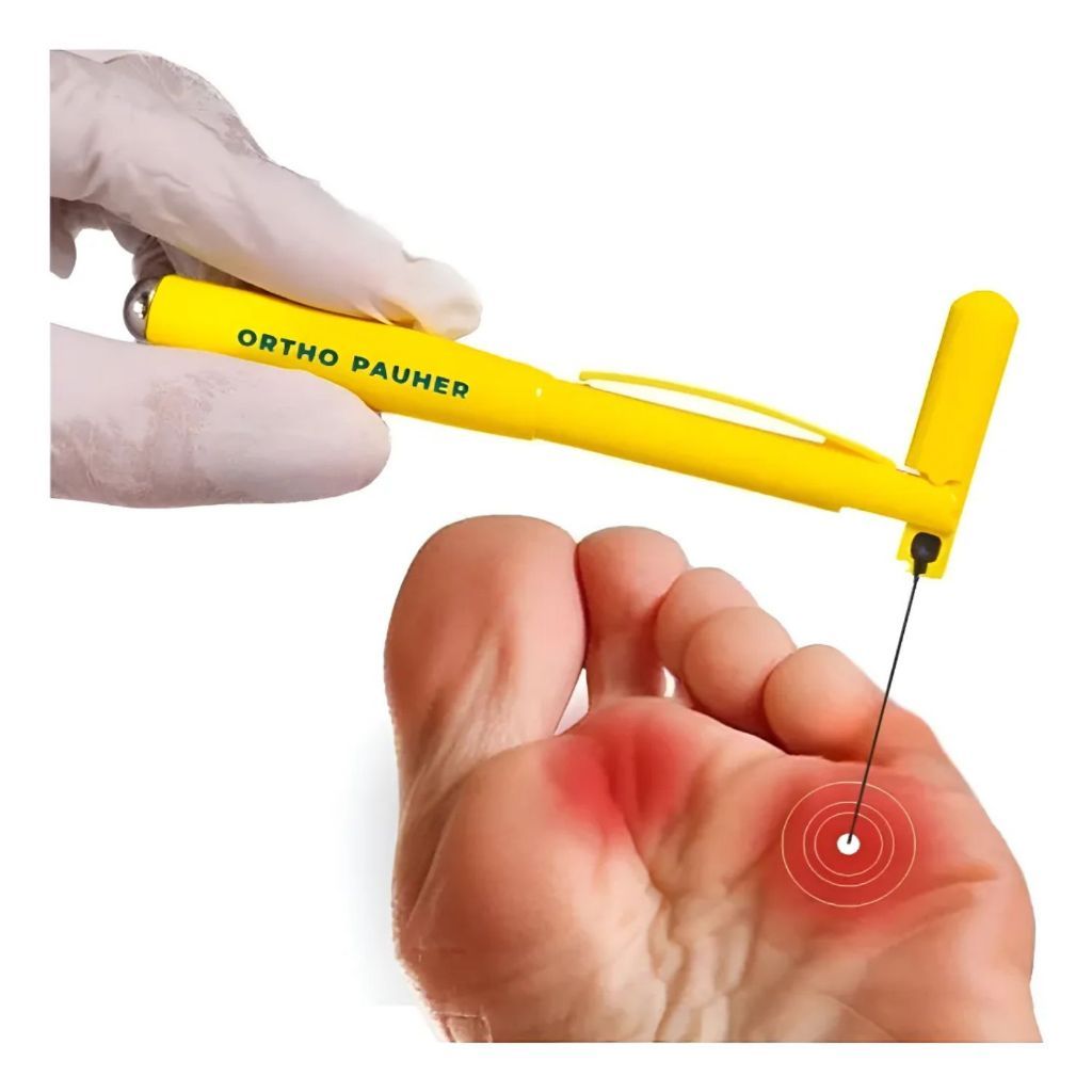 Estesiometro Monofilamento De Semmes-weinstein Ortho Pauher