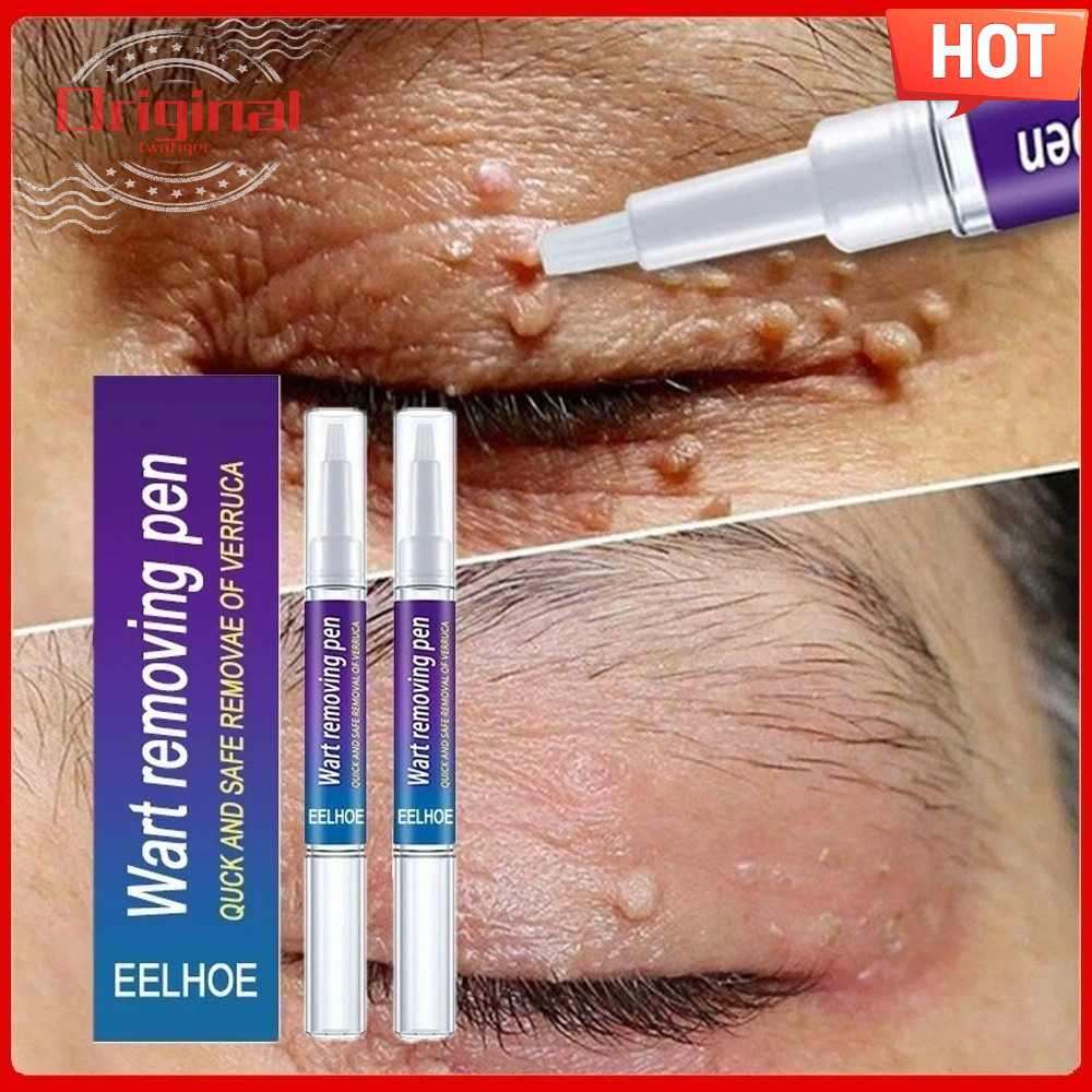 Novo Creme Para Remoção De Partículas Limpa Profundamente A Pele
