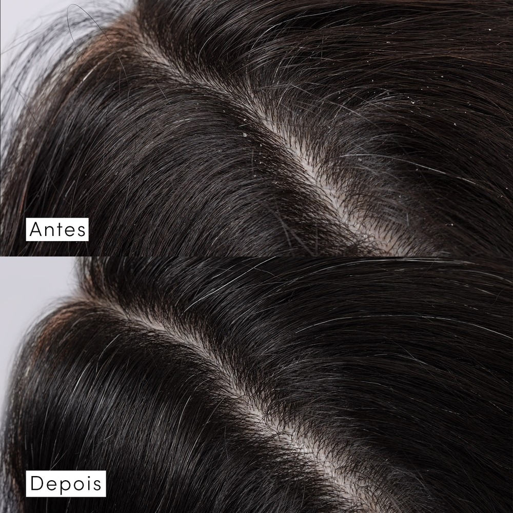 Eudora Siàge Dermo Hair Scalp Rebalance 300ml · foto 2
