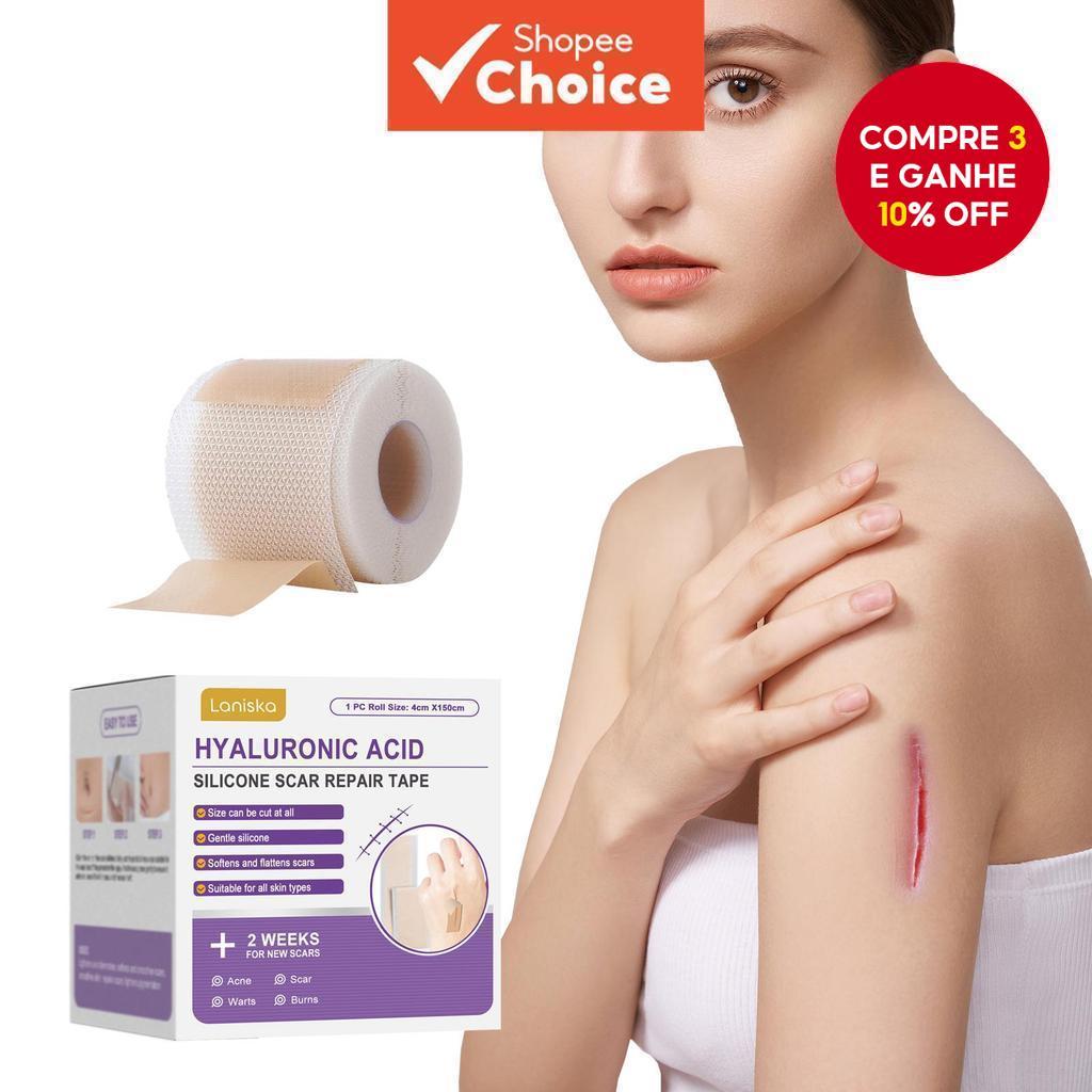 Fita de Silicone para Remoção de Cicatrizes Cirúrgicas e Tratamento de Cicatrizes de Acne/Queimaduras - 150cm de em Oferta na Shopee