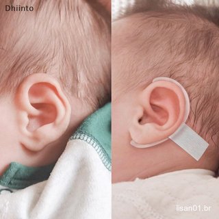 [Ferramentas De Correção De Orelha De Suporte Silicone Patch Urina De Para BabyEar Corretor