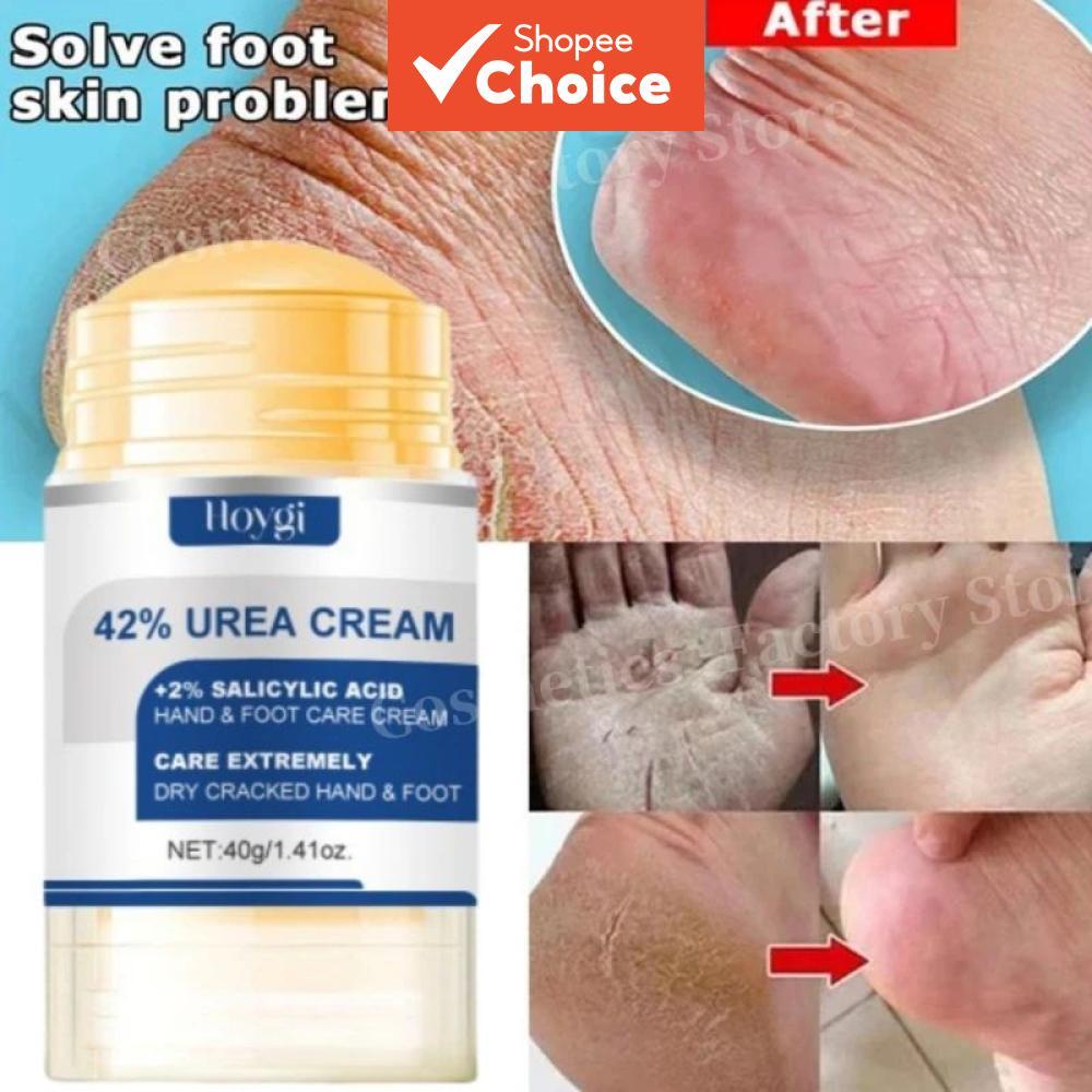  Creme para Pés com 60% de Ureia & Aloe Vera 40g - Hidrata Profundamente e Amacia Pés Rachados, Esfoliação Suave Diária