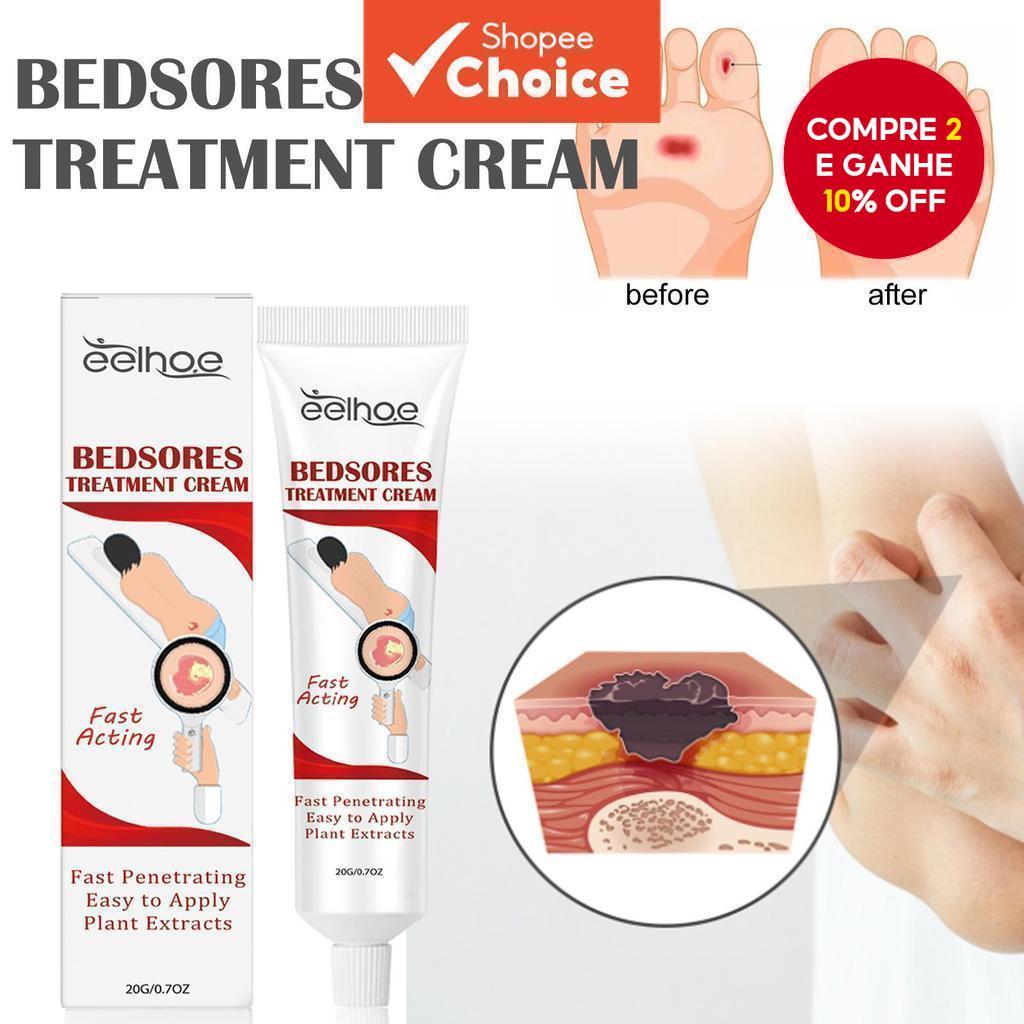 Creme para Cuidado de Úlcera de Decúbito, Creme Alívio Da Dor e Cicatrização 20g | Cicatrização Rápida para Feridas,