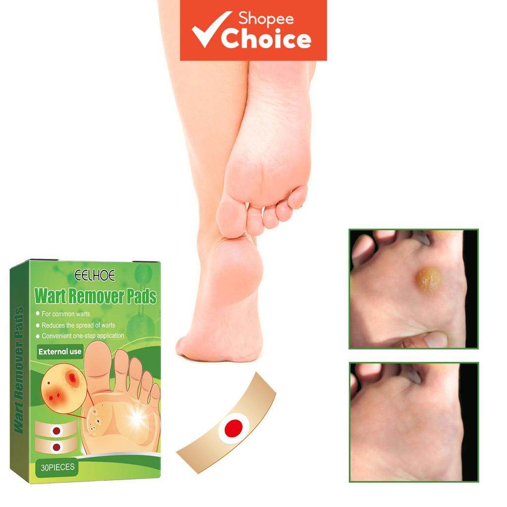  Almofadas Wart para Pés, Removedor de Calos e Olhos de Milho em um Passo, Bandagens Extra Fortes para Calosidades e
