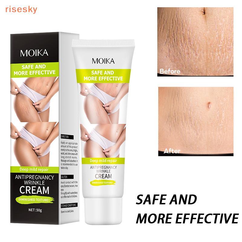 [risesky] Creme Desaparecimento De Estrias , Remove Marcas De Mama Do Corpo , Tratamento Eficaz , Reparação De Maternida