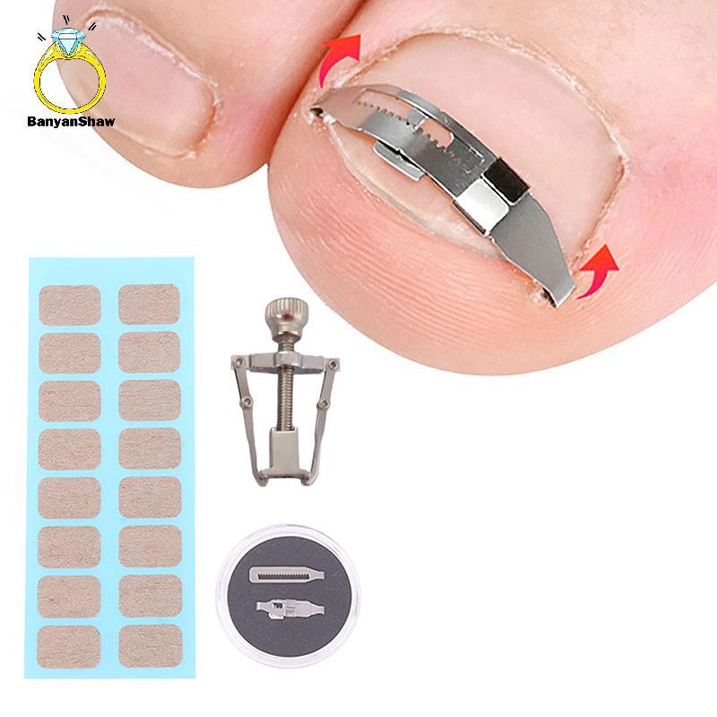 [BANY] Ferramentas Corretoras De Unhas Encravadas Pedicure Recuperar Incorporar Tratamento De Dedo Do Pé Profissional Fe