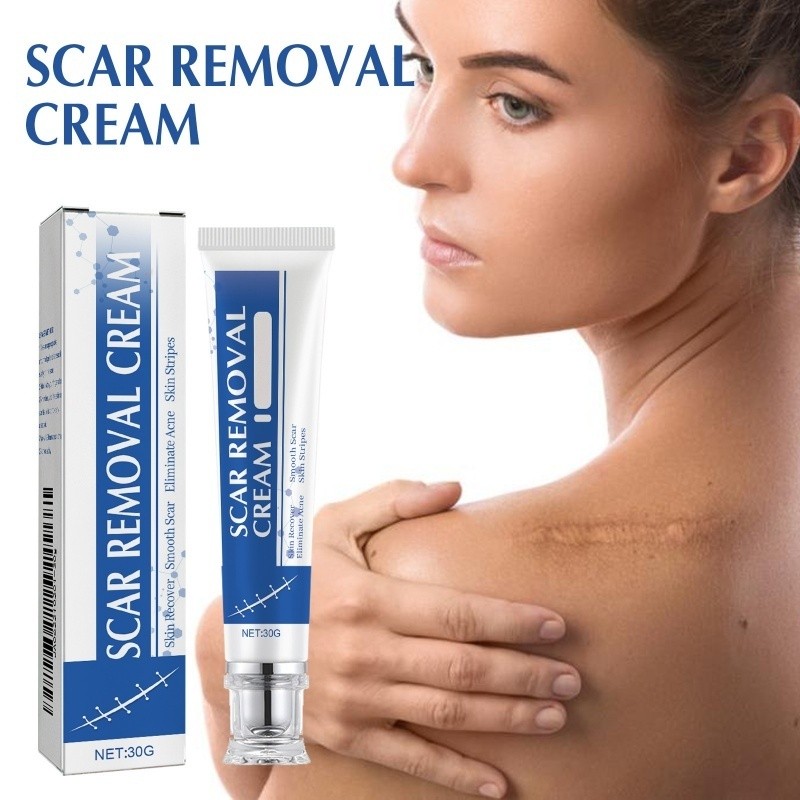 Creme Para Remoção De Cicatrizes-Adequado Restaurar A Pele , Suavizar E Eliminar acne 30g