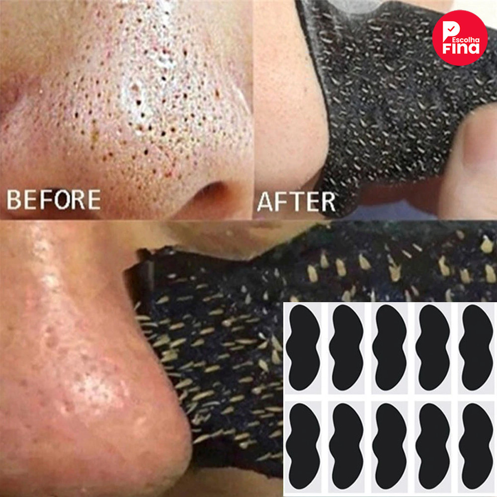 Tratamento Facial com Máscara de Carvão Remove Cravos e Limpeza de Poros