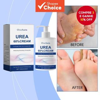Oceaura 60% Urea Creme Hidratante para Pés Alivia Rachaduras e Ressecamento Repara e Suaviza Calos e Pele Morta - em Oferta na Shopee
