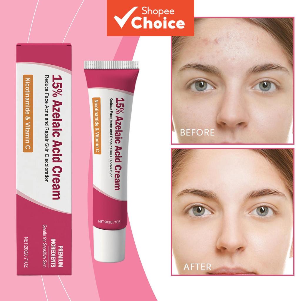 Creme Facial Niacinamida & Ácido Salicílico 20 g com Óleo de Árvore do Chá & Vitamina C – Equilíbrio de Óleo & Cuidado