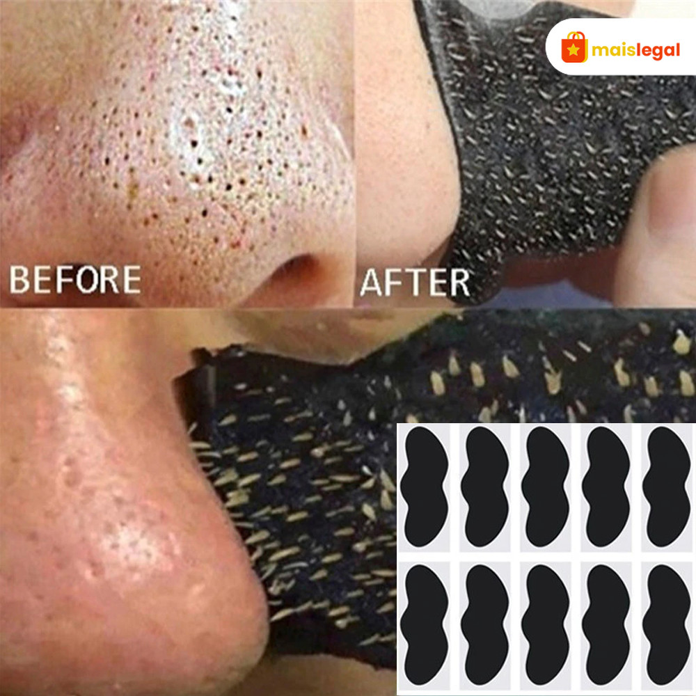 Tratamento Facial com Máscara de Carvão Ajuda a Reduzir Cravos e Promove a Limpeza dos Poros