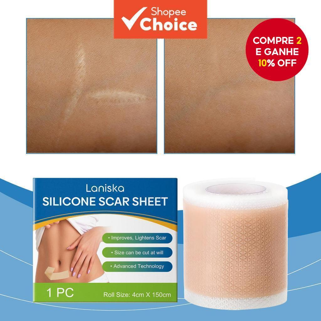 Escolha A Terapia Eficaz Do Rolo Da Fita Cicatriz Silicone Para Marcas Cirúrgicas Apropriada Todos Os Tipos De Pele 4Cm 