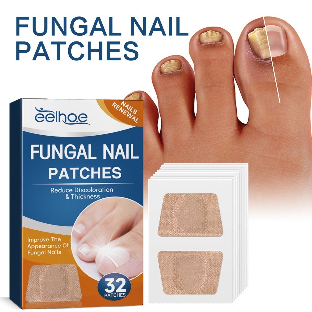 Tratamento Para Unhas Encravadas E Infecções Fúngicas . Adesivos Reparadores Grossas , Quebradiços Deformadas Cuidados P
