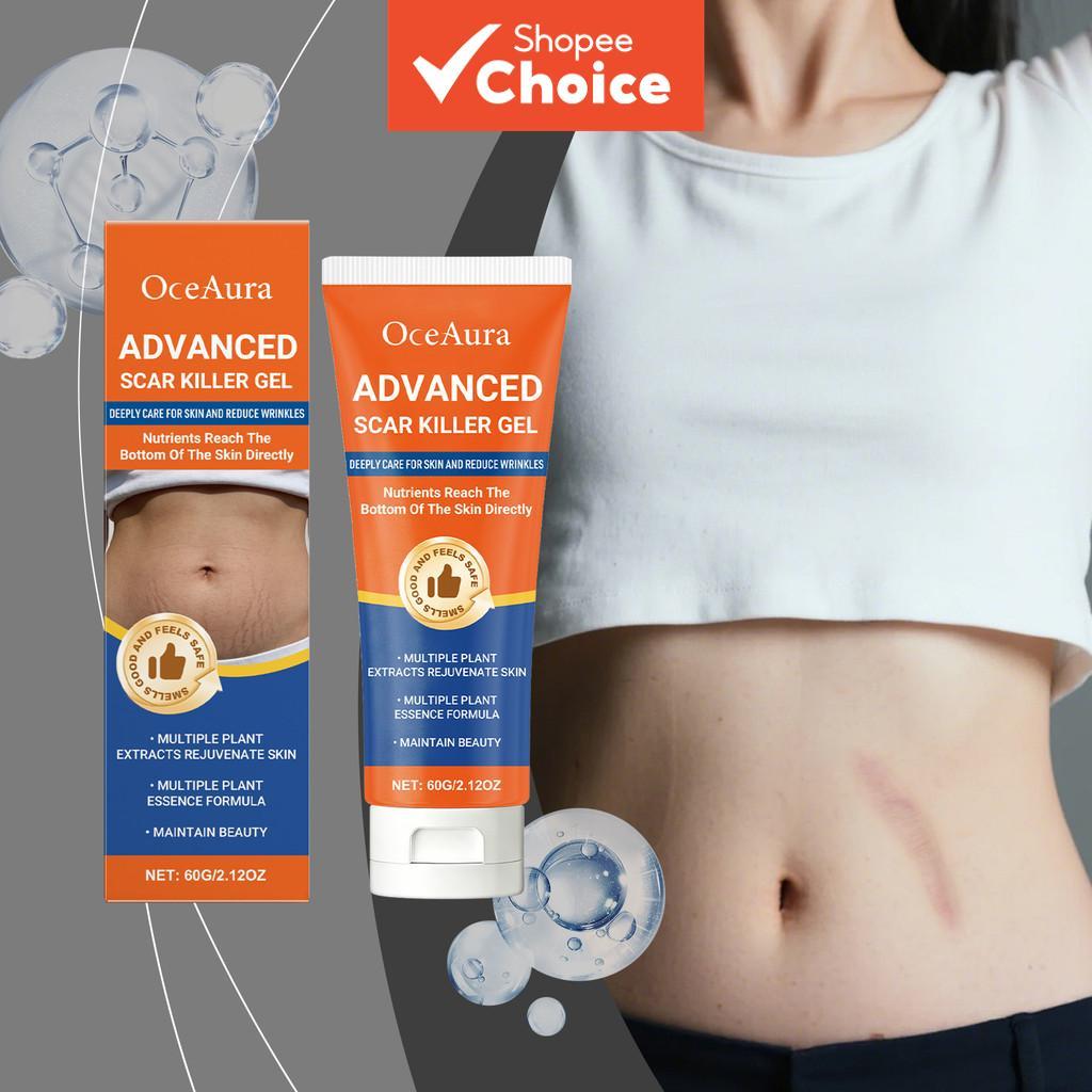 Pantenol & Ginseng Root Extract Scar Care Gel Para Feridas E Cicatrizes , Textura Calmante Suave Manteiga De Karité Pura
