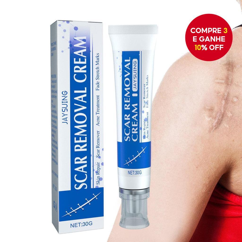 Pomada Para Cicatrizes , Creme Médico Gel Avançado Corpo , Cuidados Com Aplicação Versátil E Fácil em Oferta na Shopee