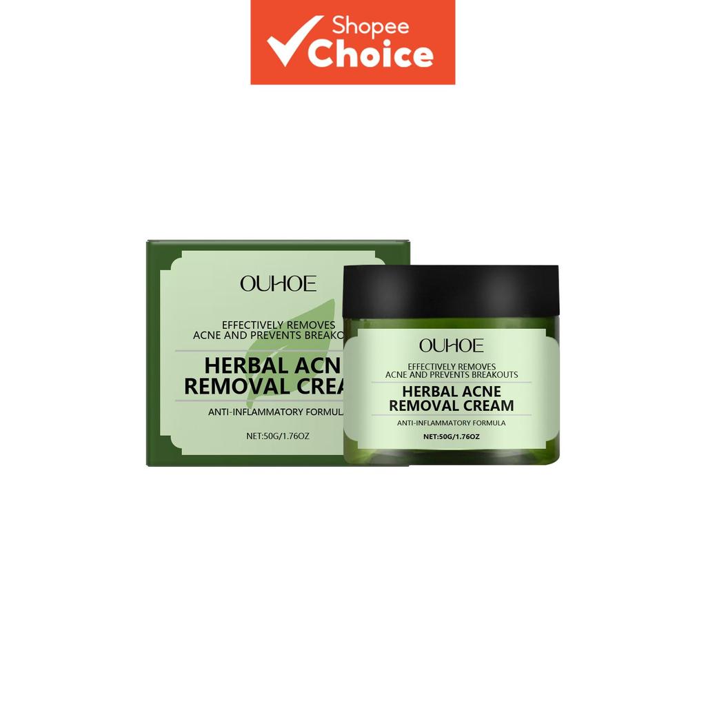 Creme Facial Para Remoção De Acne 50g , Fórmula Natural , Reparo De Cicatrizes Adolescentes E Adultos , Hidratante