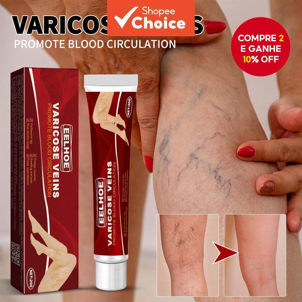 20g De Creme Para Veias Varicosas Com Gerânio , Lentilha E Erva-Mãe | Previne A Recuperação , Fórmula Não Gordurosa De A