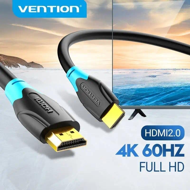 Cabo HDMI 4K Vention HDMI 2.0 Para Xiaomi Box PS4 Divisor HDMI Interruptor Cabo De Áudio E Vídeo Apple TV Cabo HDMI