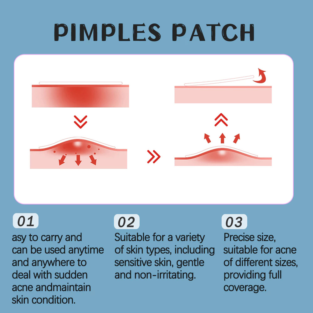 40-120 Pçs Hidrocolóide Acne Remendos Rosto Espinha Adesivos Para Zits Tratamento De Ponto Cuidados Com A Pele Essencial — imagem 2 de 2