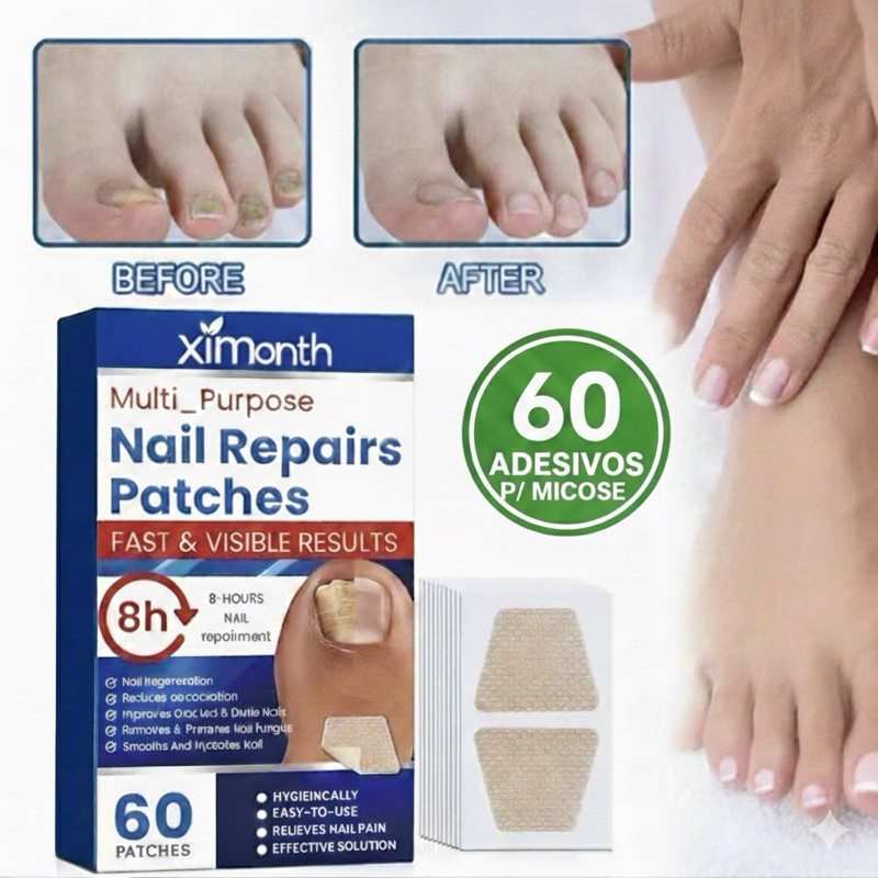 Adesivos Remendo De Fungo De Unha, 60/120 Pçs Pé Reparação De Unhas Remendo Cinza Correção Fúngica Adesivo
