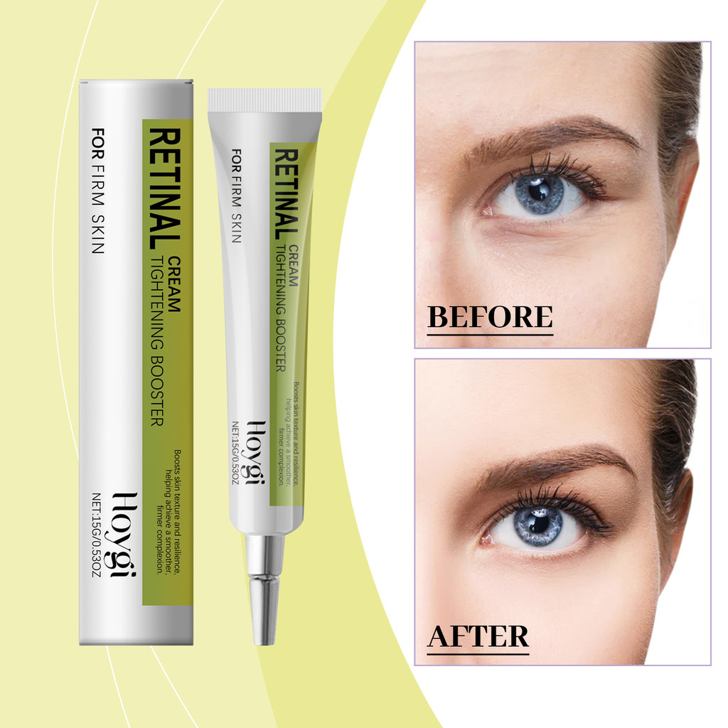 Hoygi Retinal Eye Cream Suave Nutritivo Firme Hidratante Cuidados Com Os Olhos