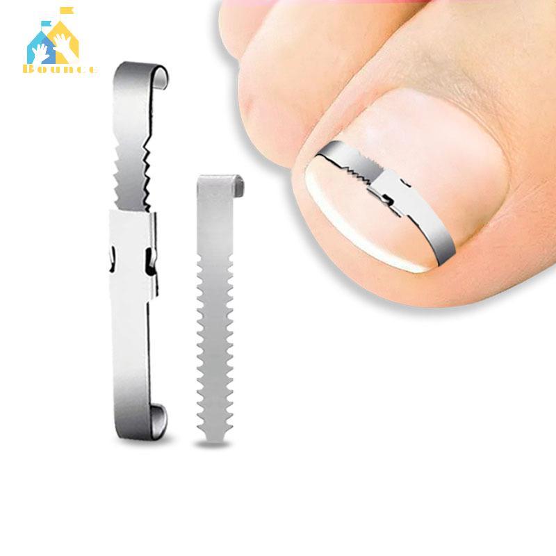 Bbounce Ferramentas Corretoras De Unhas Encravadas , Pedicure , Recuperação , Tratamento , Profissional , Correção Ferra