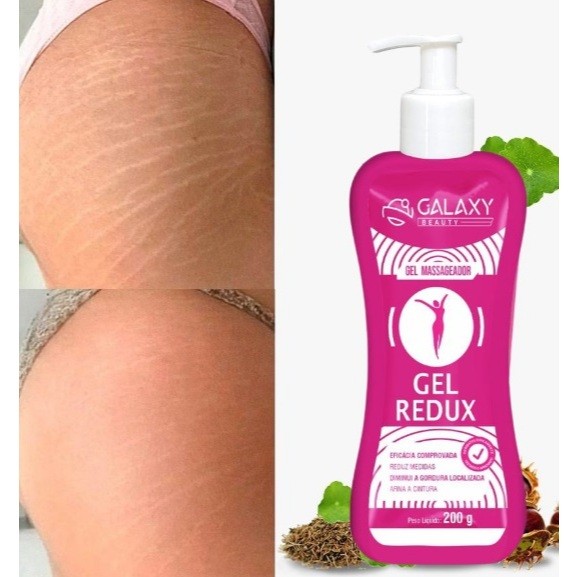 Creme 5 em 1 - Varizes, Má circulação e Câimbras, Celulites, Flacidez. em Oferta na Shopee