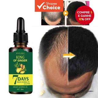 Solução Nutriente Capilar Rei Gengibre 30ML Natural e Rápida para Líquido Antiqueda de Cabelo Essência para Crescimento em Oferta na Shopee