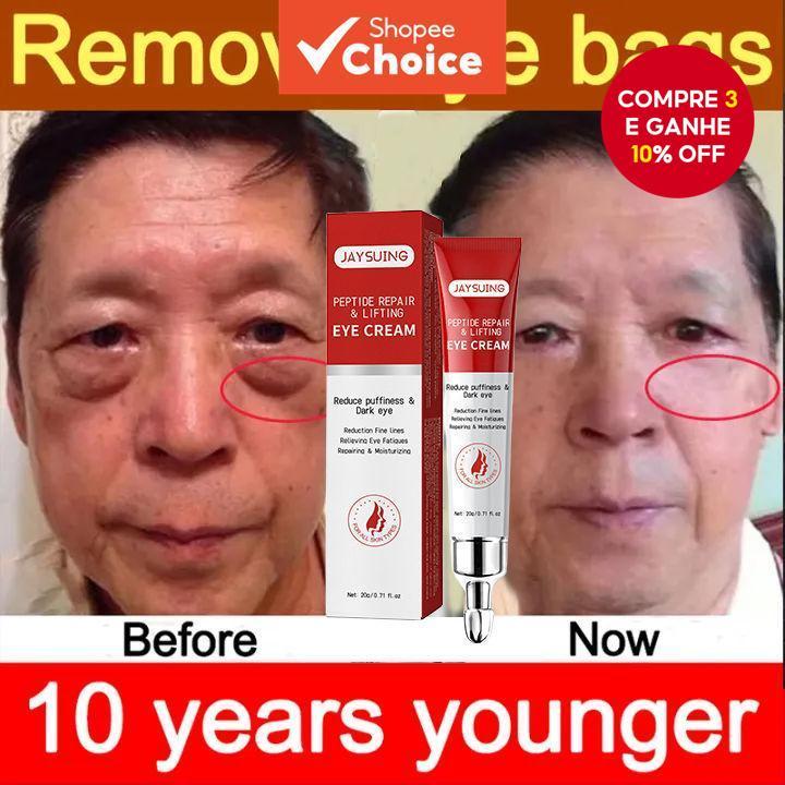  Creme Avançado para Olhos, Creme para Remoção de Bolsas, Creme para Olhos com Rugas, Removedor de Bolsas e Olheiras,