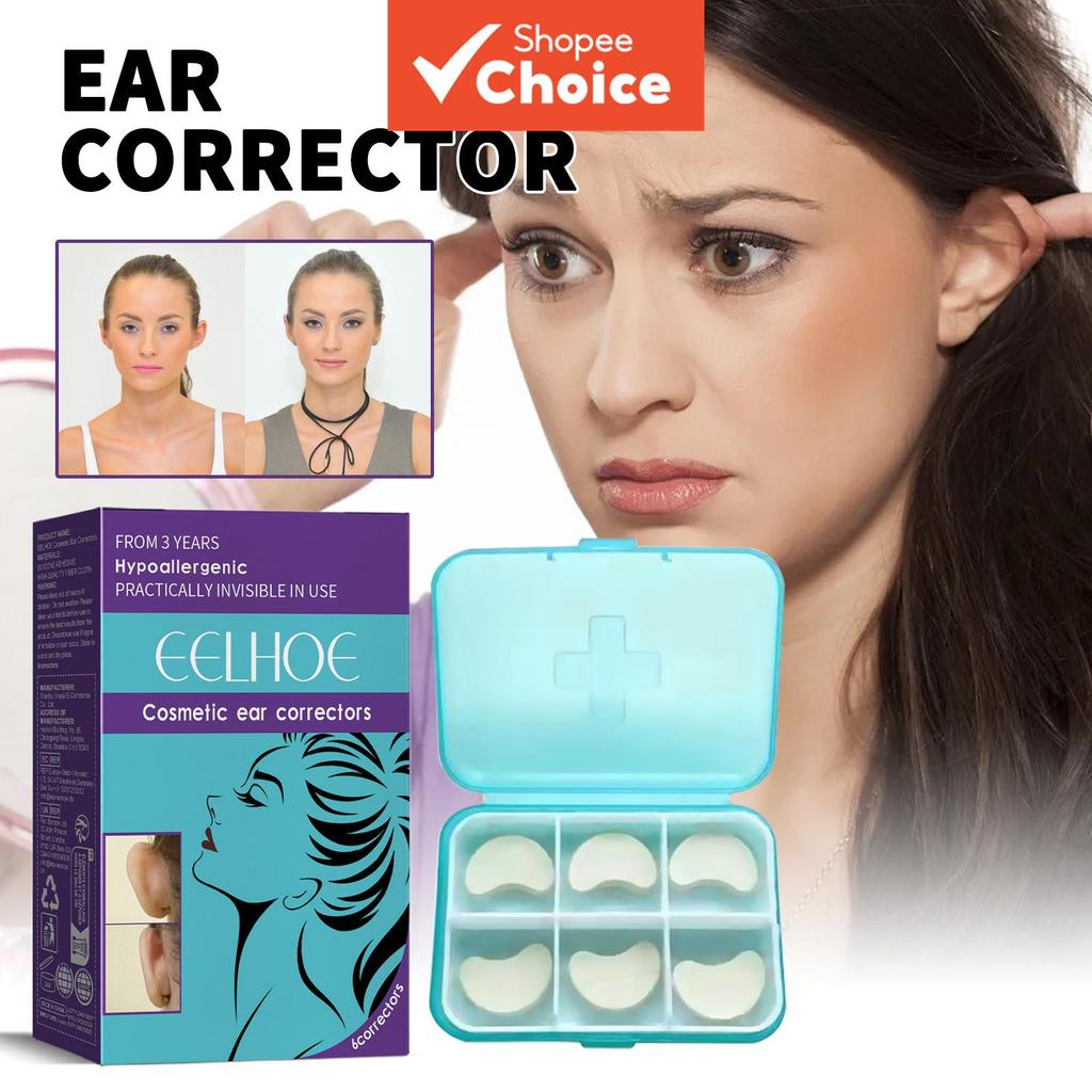 Corretor de Orelha Cosmético – Adesivos de Orelha Mais Fortes para Segurar Orelhas Proeminentes sem Cirurgia – Adesivos