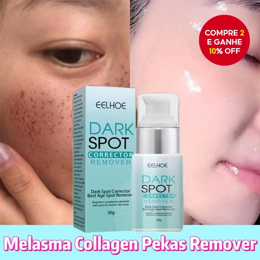 Eelhoe Corretor Avançado de Manchas Escuras Melhor Removedor de Manchas da Idade Clarear o Tom da Pele & Reduzir — R$ 24,06 em Shopee