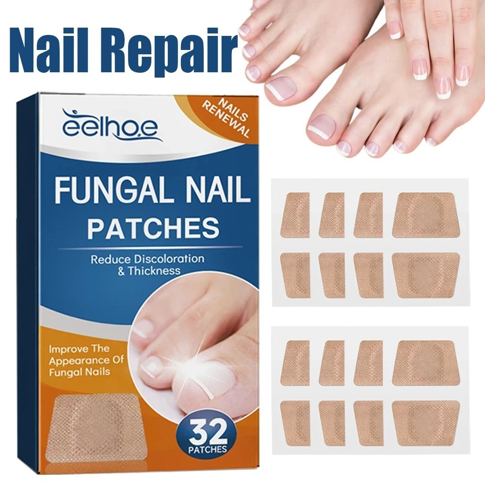 32/64 Pcs Adesivos para unha encravada  | Adesivos cinza para tratar e corrigir infecções fúngicas em Oferta na Shopee