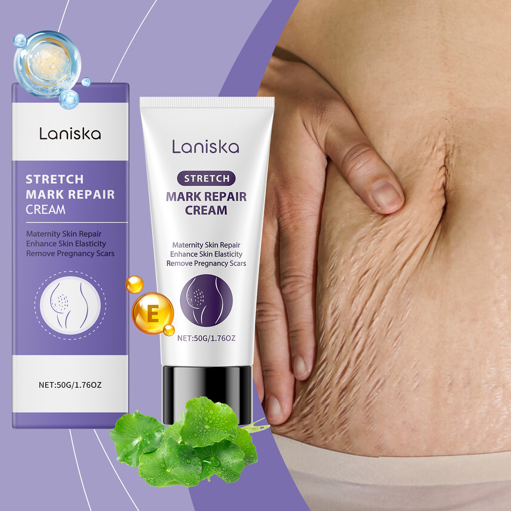  Creme Corporal de Reparação 50 g – com Alantoína e Ácido Hialurônico – Ajuda no Clareamento de Estrias, Melhora a