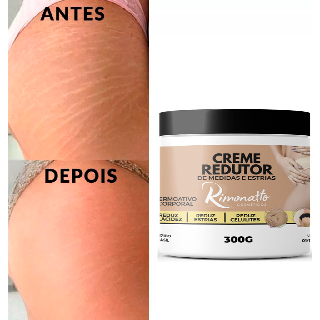 Creme hidratante de ureia Anti Estrias Removedor de Estrias 300g Rimonatto cosmeticos Resultados Reais