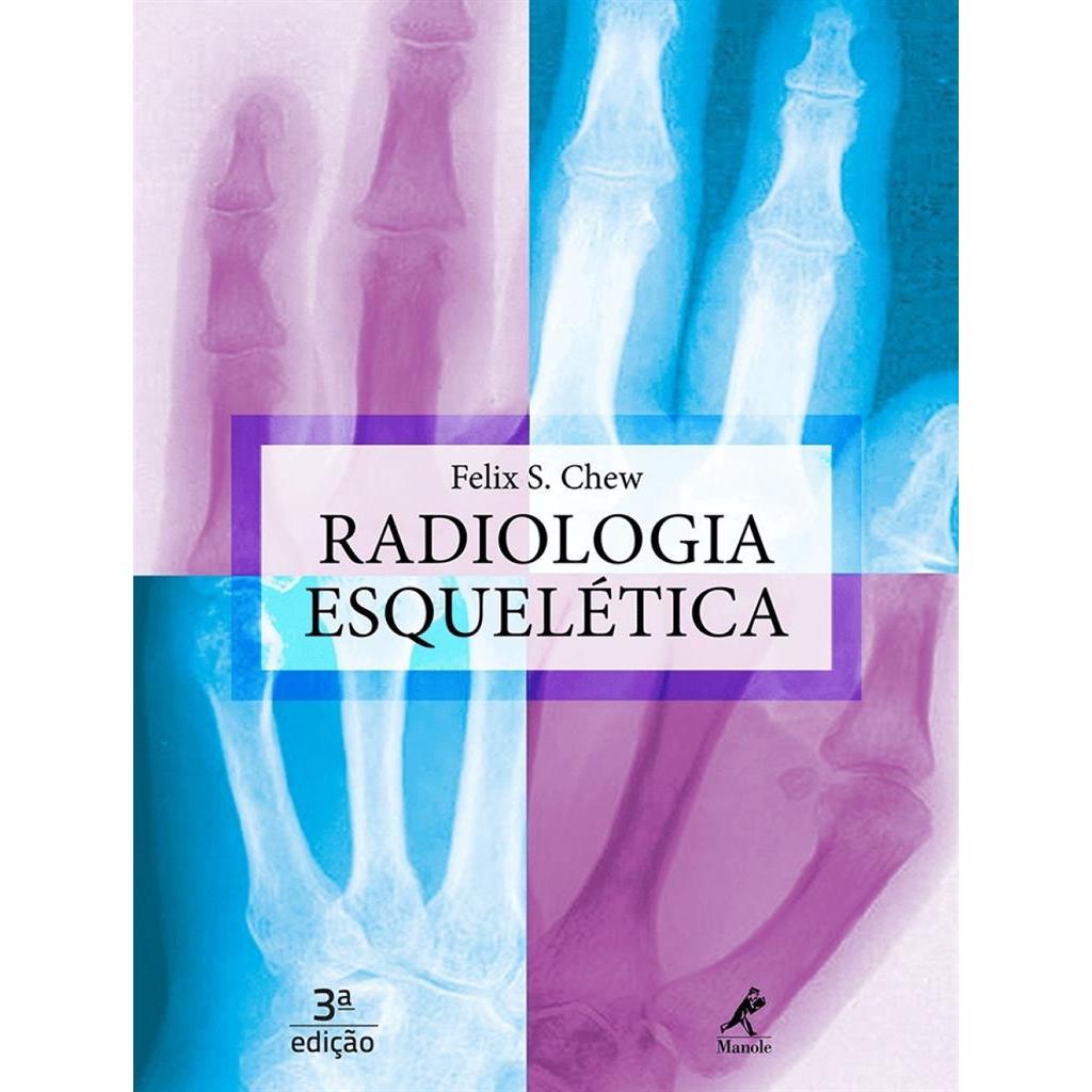 Radiologia Esquelética autor Falix S. Chew