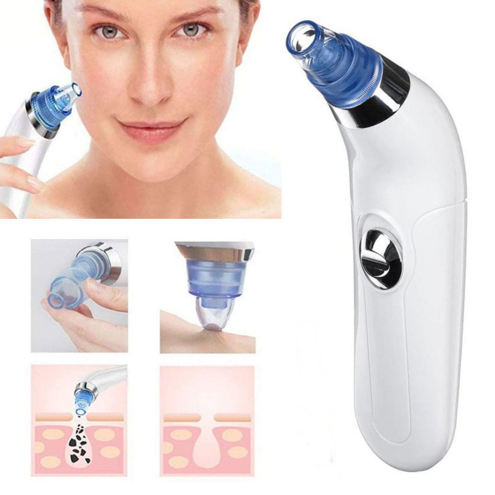 Removedor de Cravos e Espinhas Sem Fio Dermasuction Skincare