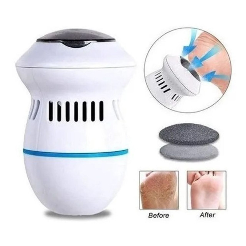 Removedor Elétrico de Calos Portátil, Recarregável com 2 Velocidades, Cuidados com os Pés Esfoliante