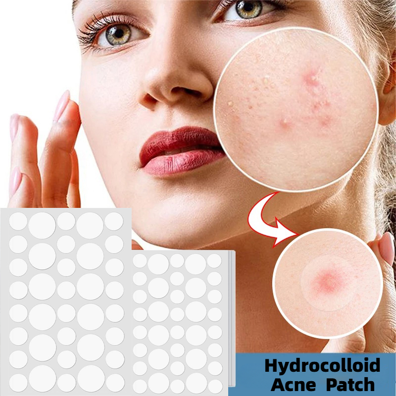 36 Peças De Adesivo Para Acne Rosto , Adesivos Hidrocolóides Espinhas E Manchas Fugas , Kit De Ferramentas Popper De Pel