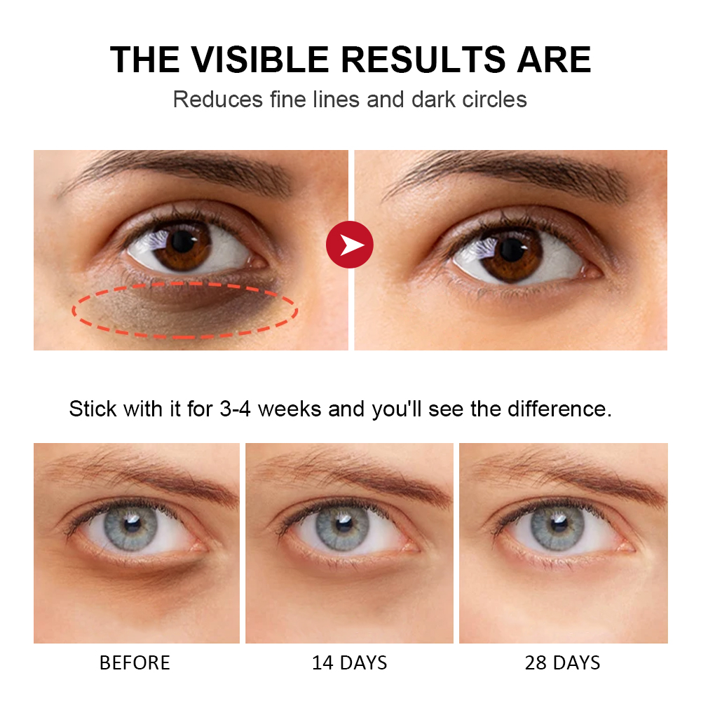 Bastão de Creme para os Olhos com Retinol 3g: Reduz Bolsas nos Olhos, Combate Olheiras & Hidrata a Área dos Olhos · foto 2