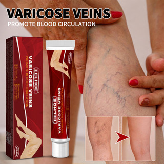 20g De Creme Para Veias Varicosas Com Gerânio , Lentilha E Erva-Mãe | Previne A Recuperaç…