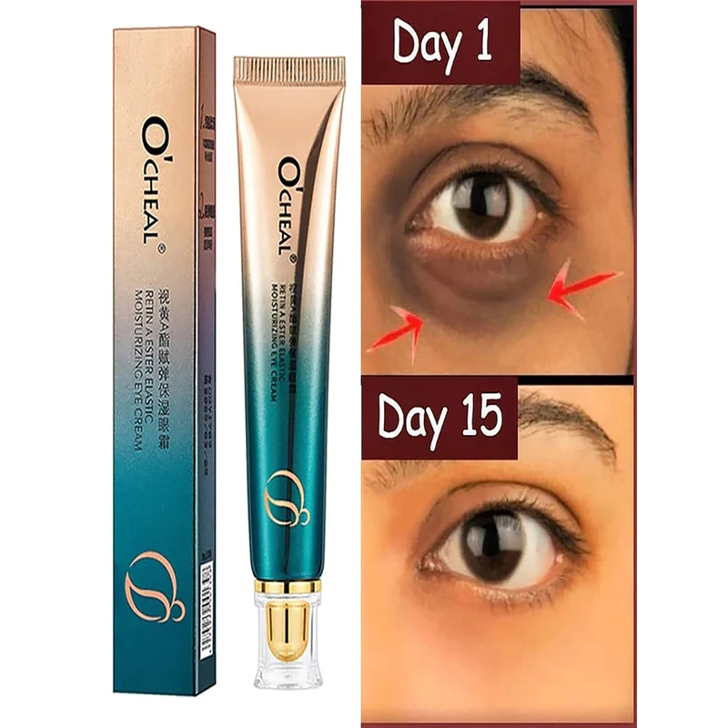Olhos Revitalizados: R$ 12,22! 🌟