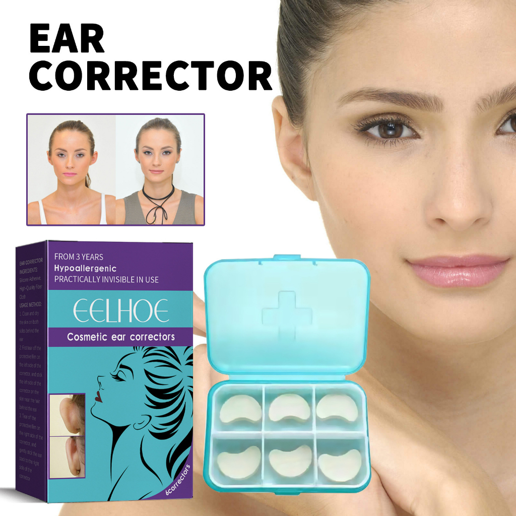 Corretores de Orelha, Silicone para Problemas Grandes de Orelha, Correção de Orelha de Valgo, Ortóteses Resolvem